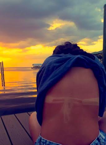 Why it's important to wear sunscreen