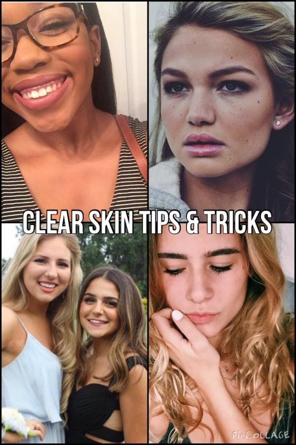 Tips and tricks for clearer skin!